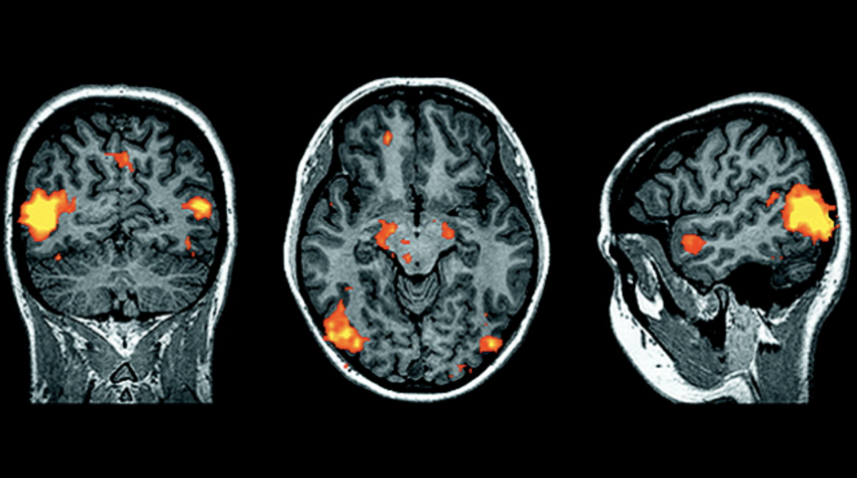 The Biology of Aggression